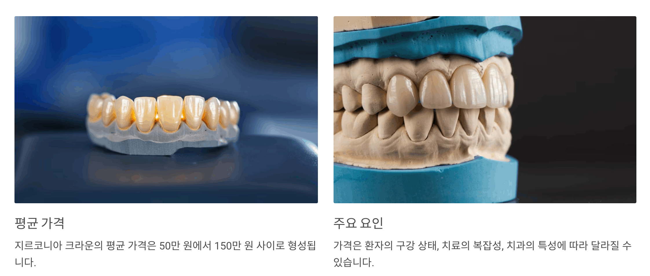 지르코니아 크라운 가격