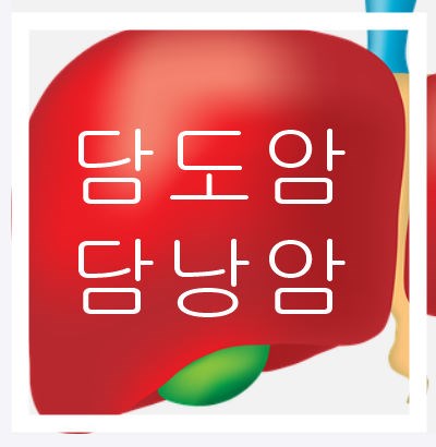 담낭암 증상 및 수술 치료와 담낭암 초기증상 및 담도암 생존율