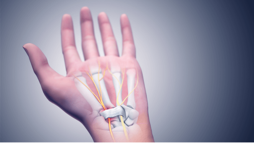 손목통증 및 치료방법(재활운동)