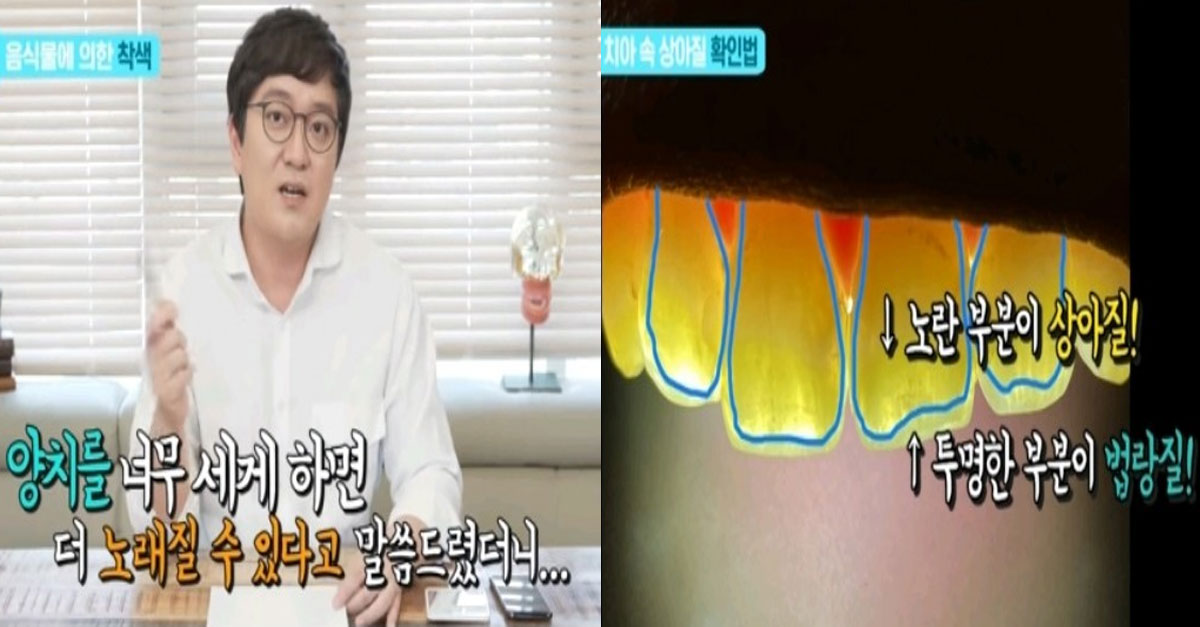  치아가 누렇게 변하는 진짜 이유