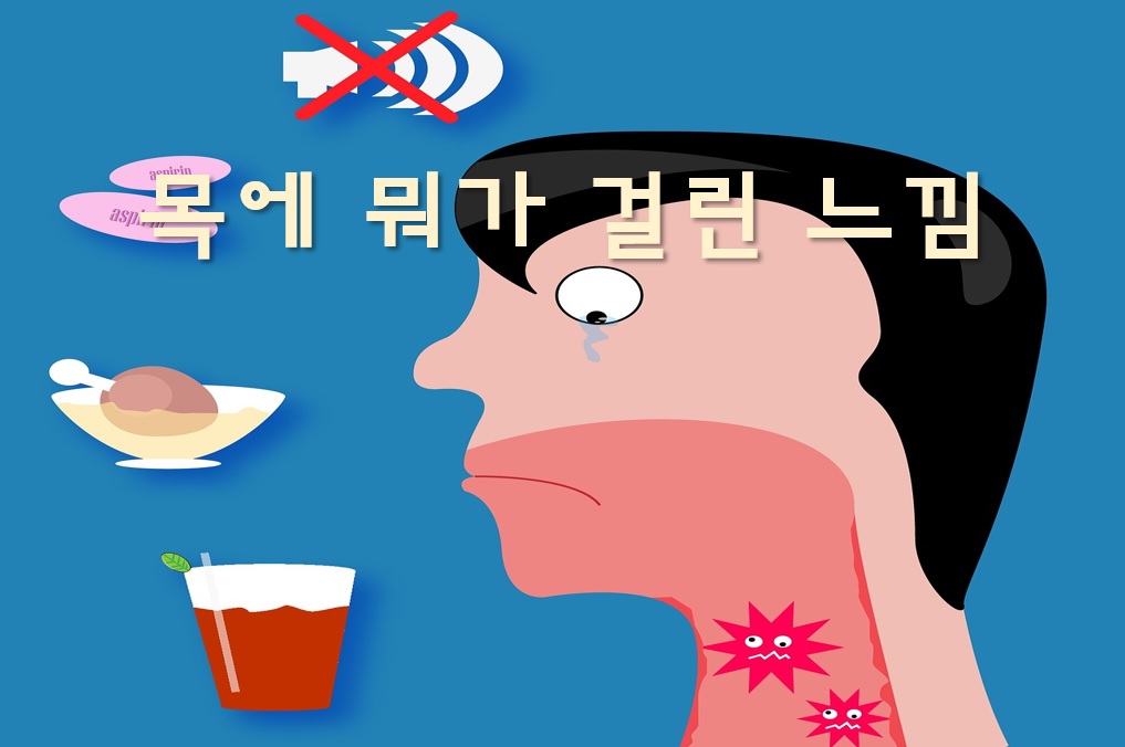  목에 이물감이 느껴지는 원인과 목에 뭐가 걸린 느낌