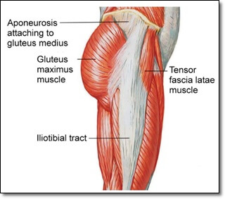 둔근과 대퇴골 외측면을 보여주는 그림으로 둔부 건막을 나타낸 그림