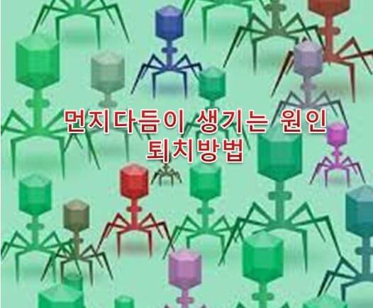 먼지다듬이 원인, 퇴치방법 먼지다듬이 원인, 퇴치방법