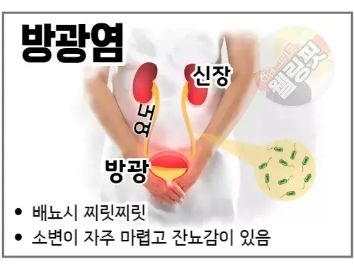 방광염이-있으면-소변볼-때-찌릿찌릿한-증상이-발생합니다.