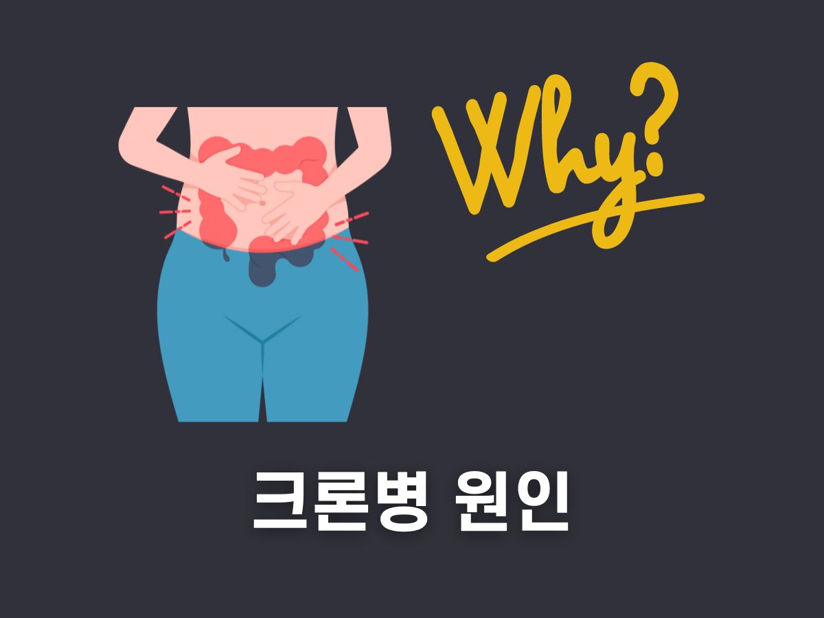 크론병 원인