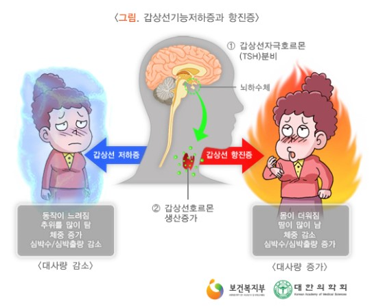  산후풍일까?갑상선호르몬 문제일까?