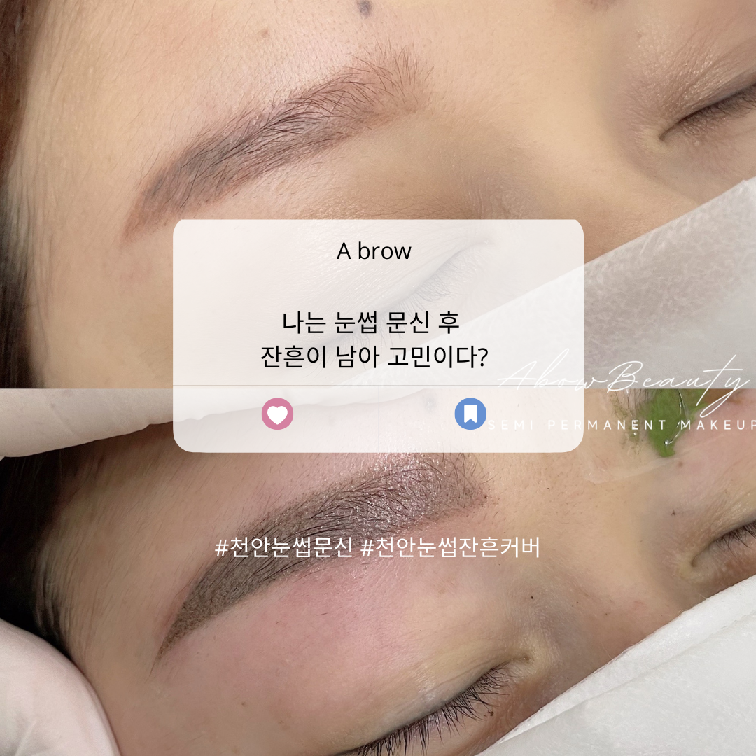  천안 눈썹문신, 잔흔제거도 데미지 없이 깨끗히!