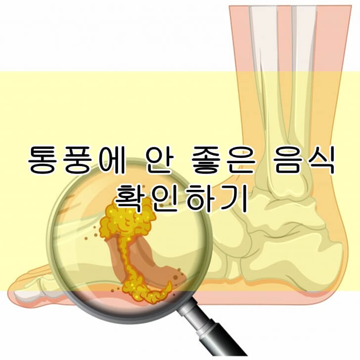 통풍에 안좋은 음식