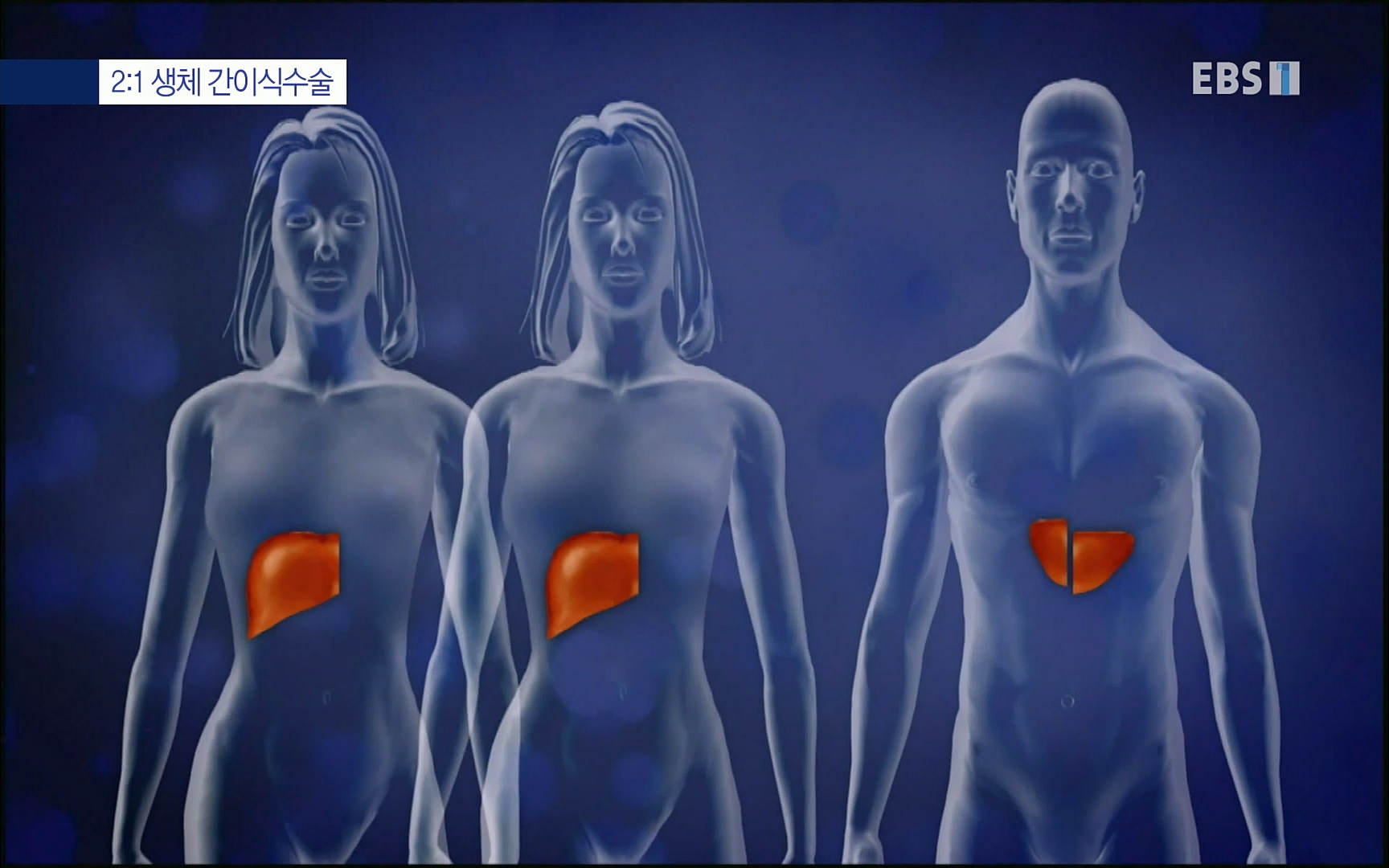 EBS 명의 헬스케어 - TV - 교육의 중심 EBS명의 15년 - 간, 완치에 도전하다.mp4_20220802_202414.494.jpg