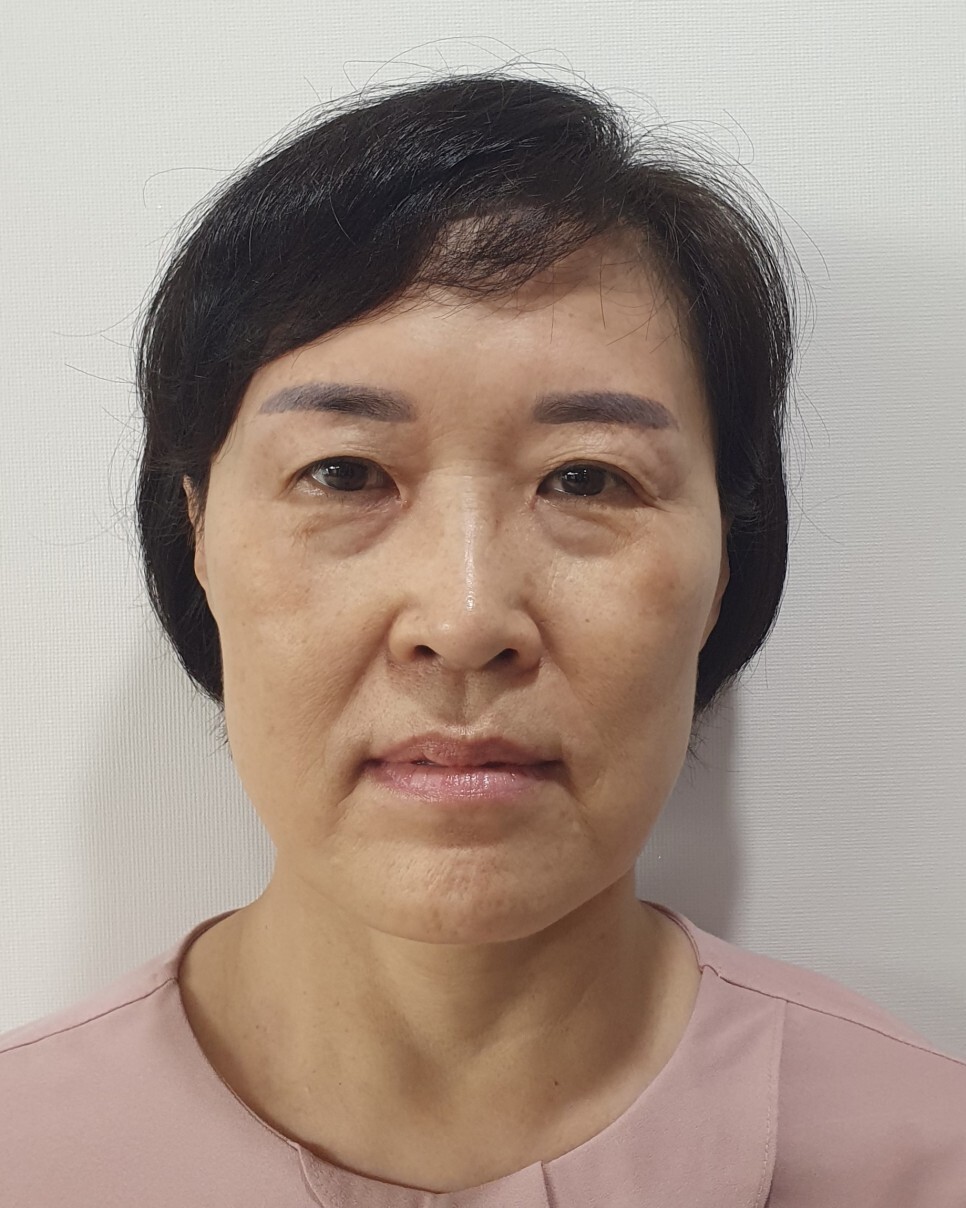  [ i'm '동안'이에요] 15년 젊어져버린 우리엄마 비결은? 