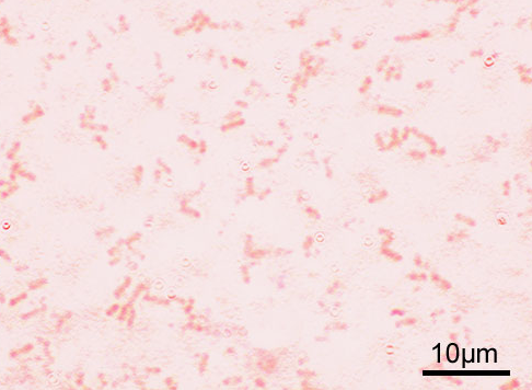  적리균(Shigella)