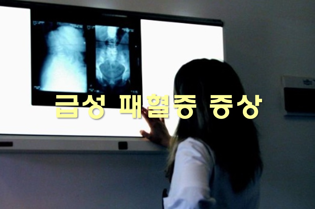  급성 패혈증 증상과 치료 방법
