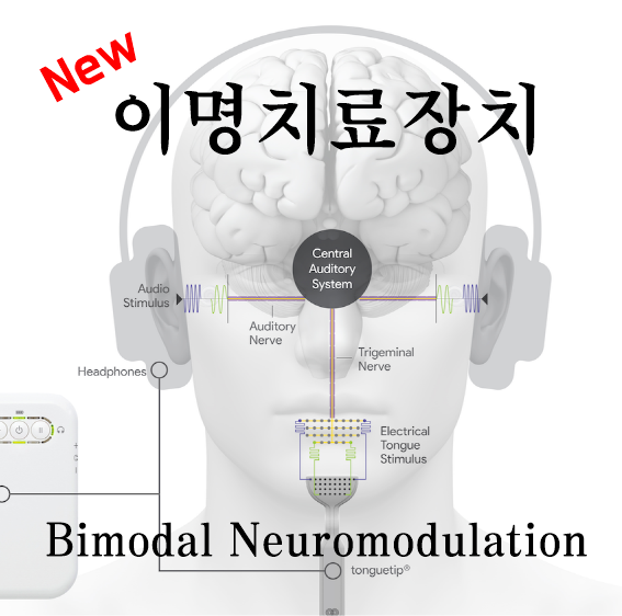  혀의 소리와 전기적 자극을 통한 귀 울림(이명) 치료 연구 발표