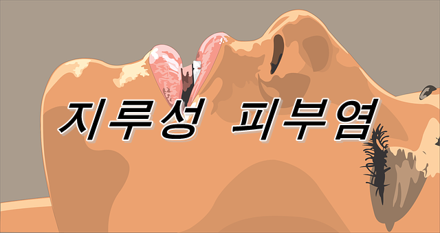  두피나 얼굴에 생기는 지루성 피부염을 치료하는 방법은?
