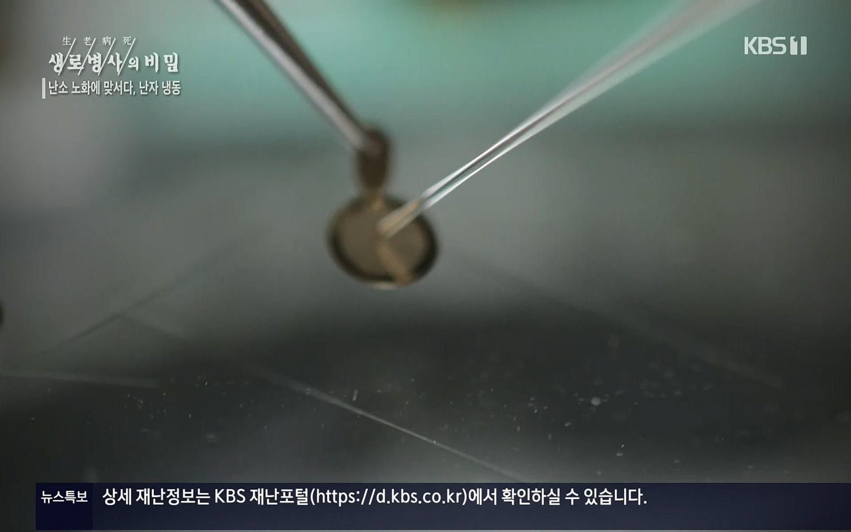 생로병사의 비밀.E836.220921p.H264-F1RST.mp4_20220925_183646.287.jpg