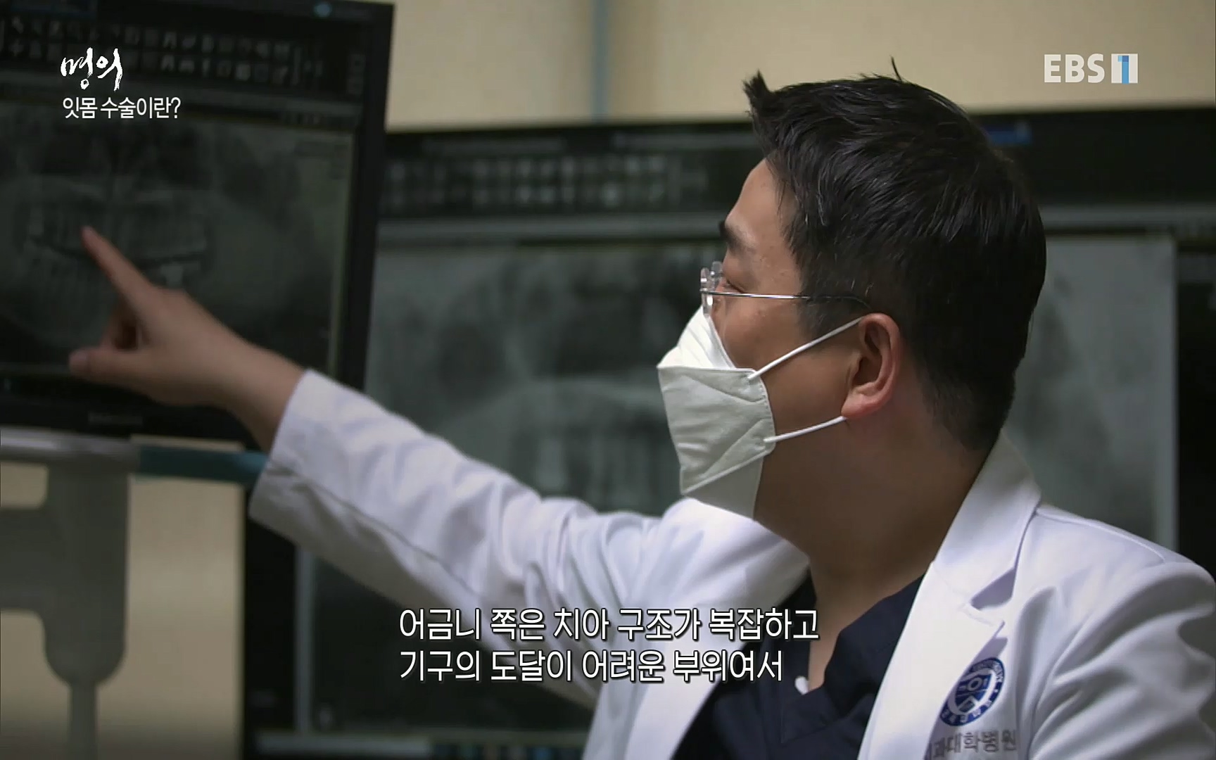 EBS 명의 헬스케어 - TV - 교육의 중심 EBS치주염이 코로나로 소홀해진 구강관리가 치아를 더 망가트리고 위험하게 만들며, 증상이 없기 때문에 특히 더 조심하고 치은염 단계에서 진행되지 않도록 예방해야한다 정의원 교수님과 치_20220505_151725.710.jpg