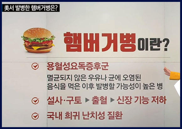  햄버거병이란? 무엇인지 알아볼까요~