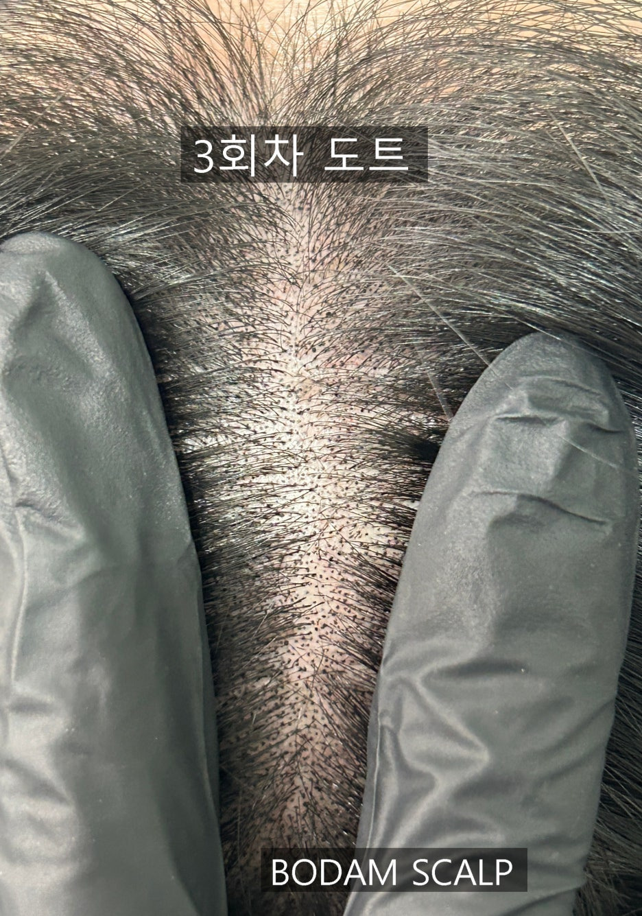 보담 이미지