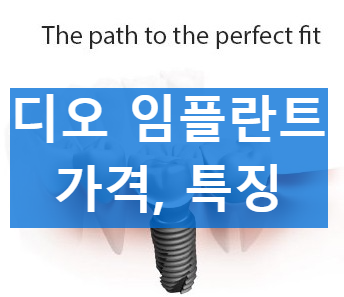 디오 임플란트