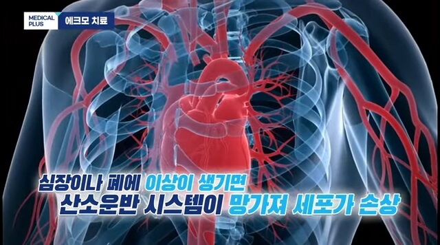 체외순환사-하는일-연봉-자격조건확인하기