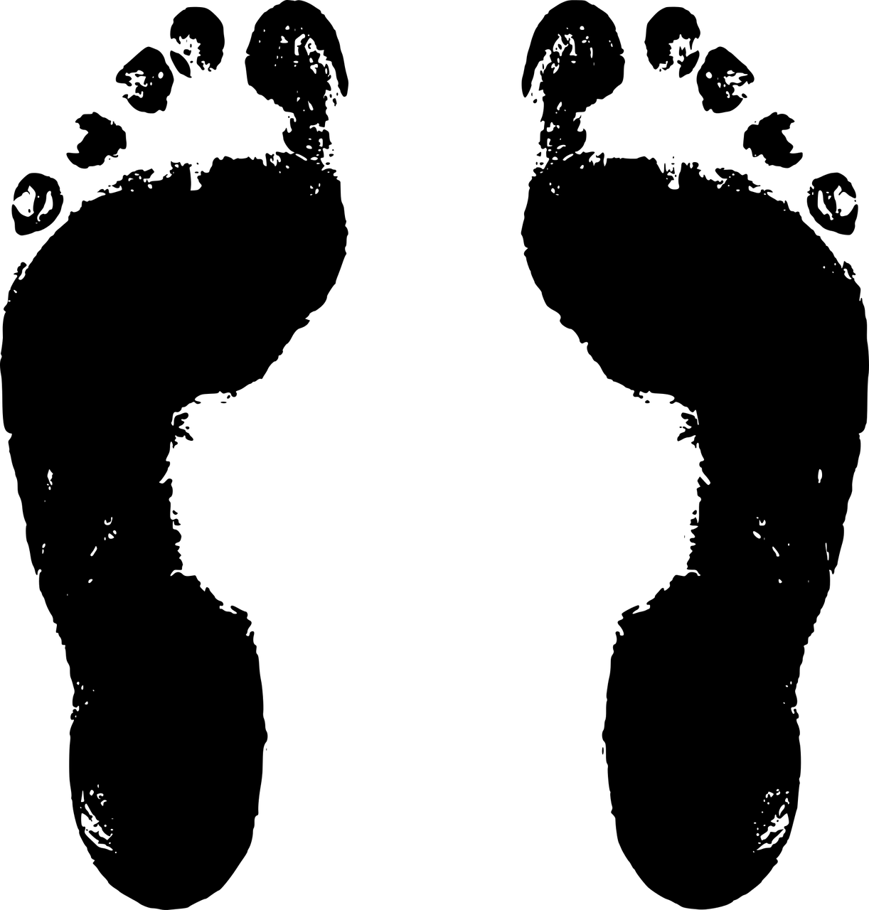  다한증 치료와 방법