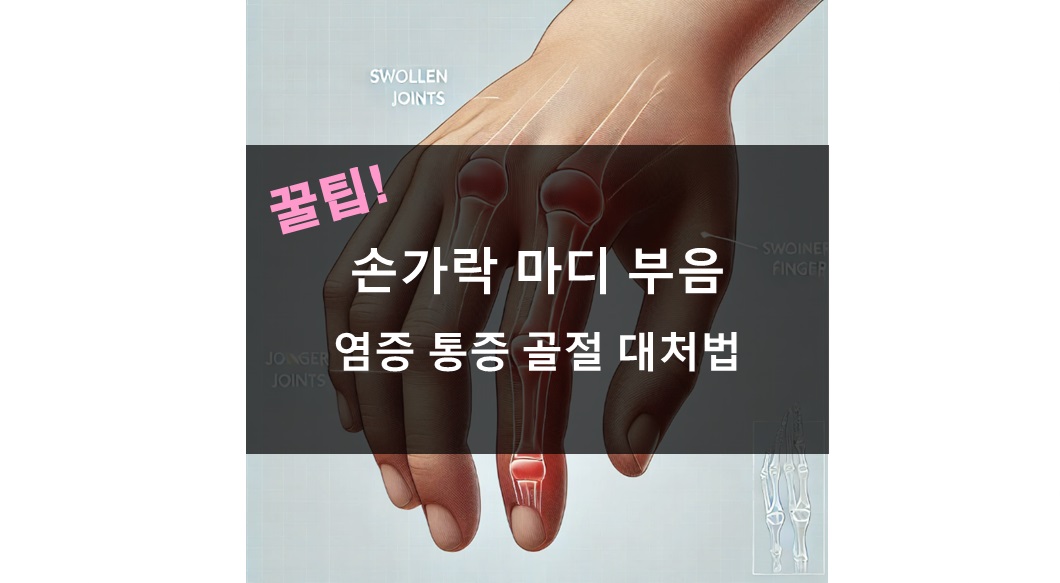 손가락 마디 부음