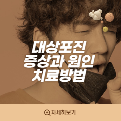  대상포진  증상, 원인, 치료 방법 / 온전히 나의 이야기.