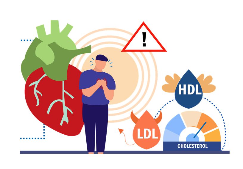 HDL 콜레스테롤과 LDL 콜레스테롤