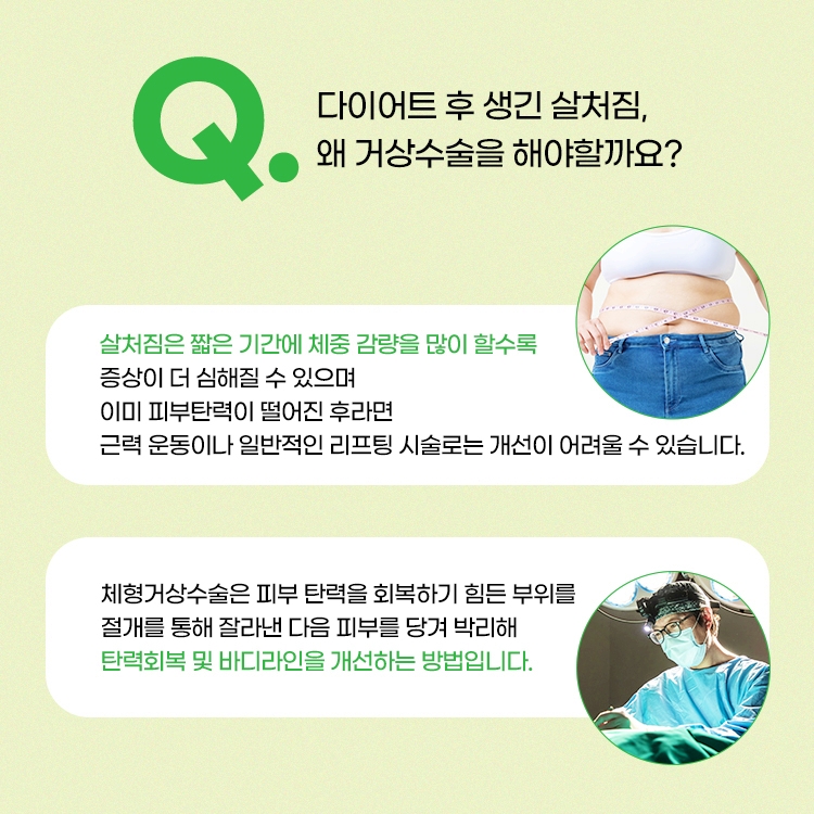 살처짐은 짧은 기간에 체중 감량을 많이 할수록 증상이 더 심해질 수 있으며 이미 피부탄력이 떨어진 후라면 근력운동이나 일반적인 리프팅 시술로는 개선이 어려울 수 있습니다.