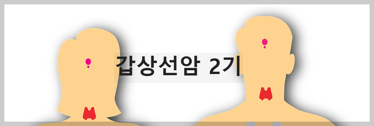 갑상선암 2기