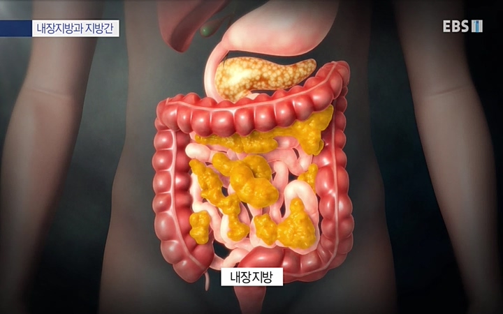 명의_ 제 764회 〈지방간의 경고 1부, 살찐 간이 위험하다〉_ 220429.avi_20220503_193632.994.jpg