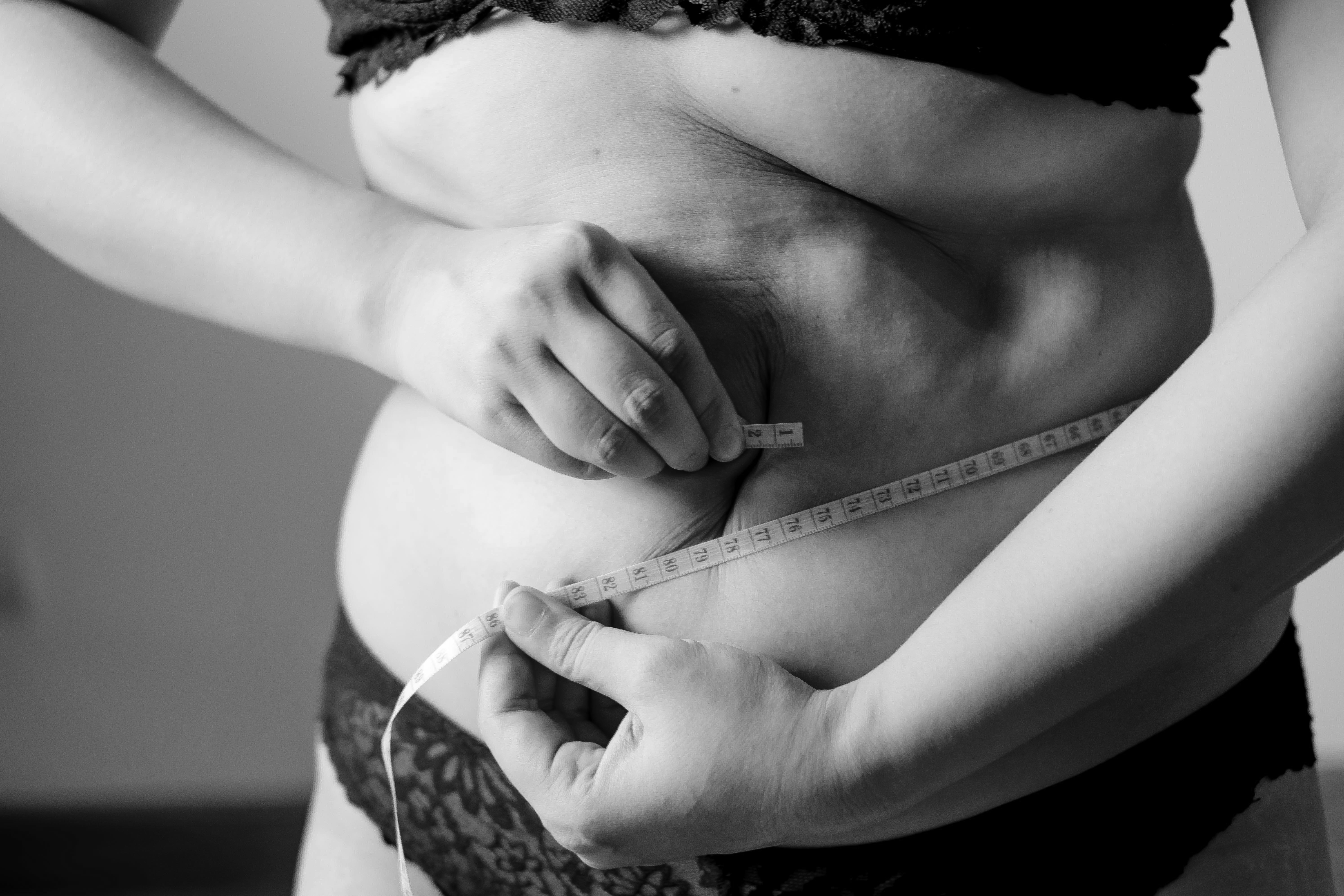 위고비 처방 받는 법 : 일론 머스크, 빠니보틀도 맞은 그 다이어트 주사