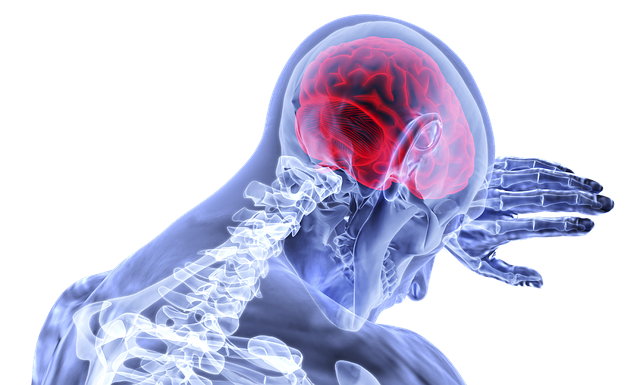 우황청심환 효과 뇌졸중