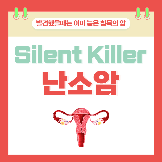  부인과 암 중 사망률 1위 침묵의 암, 난소암의 초기 증상
