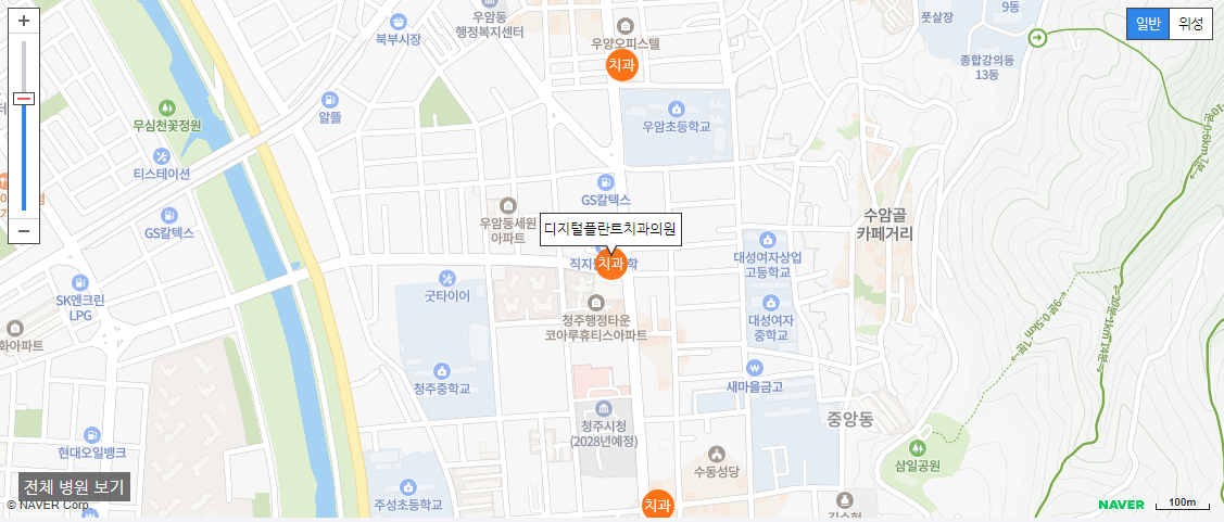 청주시 일요일 진료 치과 디지털플란트치과의원