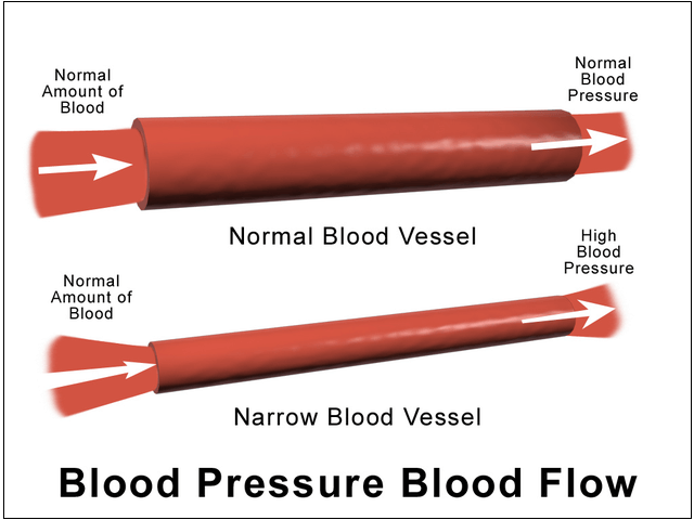  고혈압에 아연(Zinc)의 놀라운 효과 Discovery offers a potential new pathway to treat hypertension