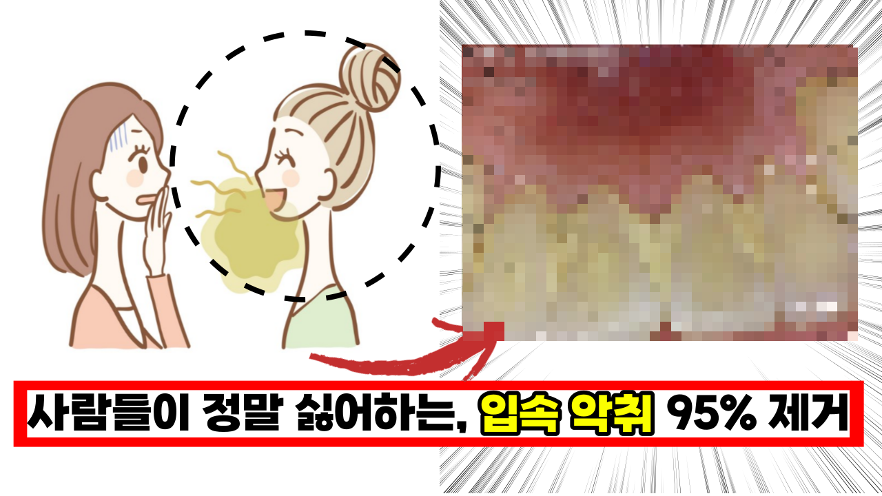  입에서 나는 악취의 원인, '스케일링' 안하면 사람들이 같이 있기 싫어해요 (+건강보험적용)
