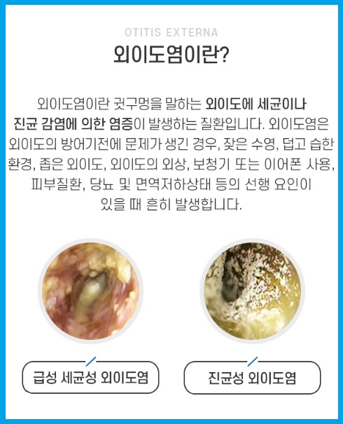 외이도염 증상 외이도염이란