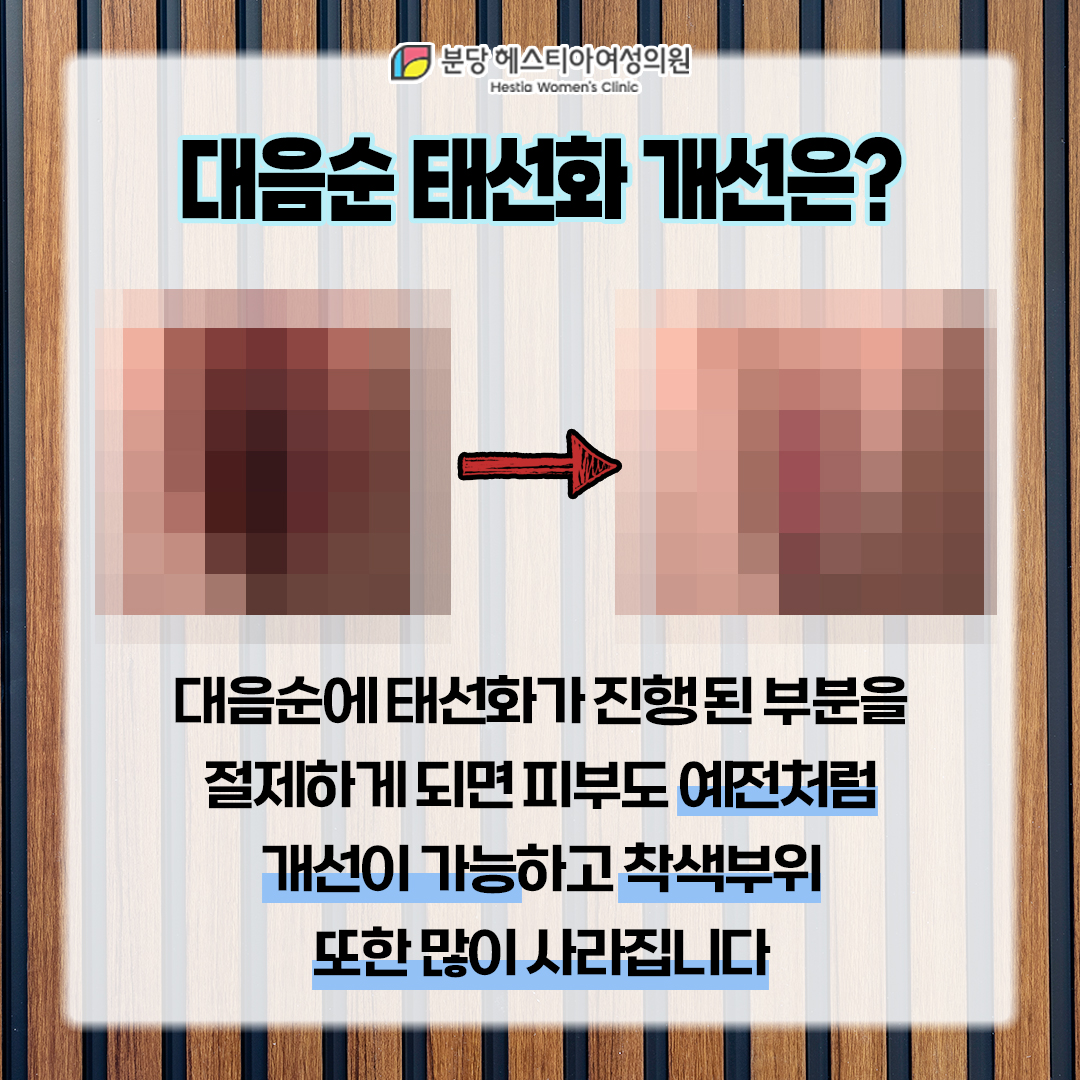 성남시 산부인과 분당구산부인과 사타구니 습진 착색 성남시 산부인과 대음순 태선화 개선되나요?