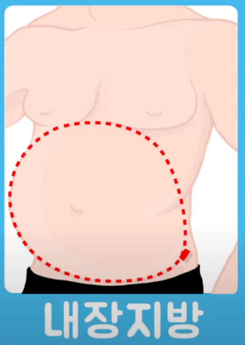 남자-내장지방-예시