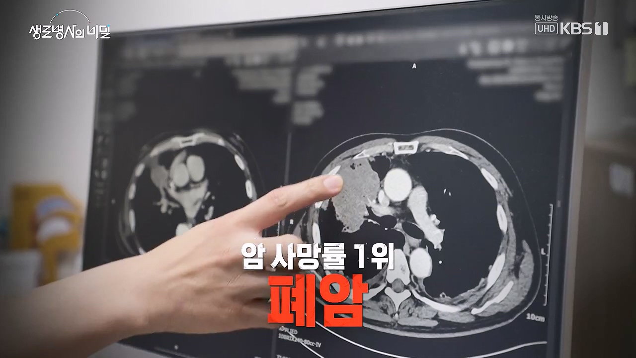 생로병사의 비밀.E916.240620p-NEXT.mp4_20240620_194954.049.jpg