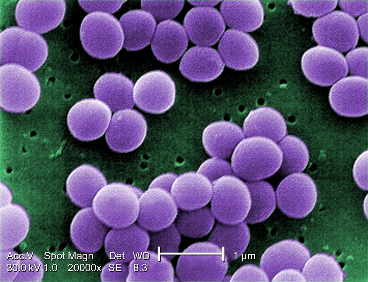 봉와직염 원인 황색포도상구균(Staphylococcus aureus) 