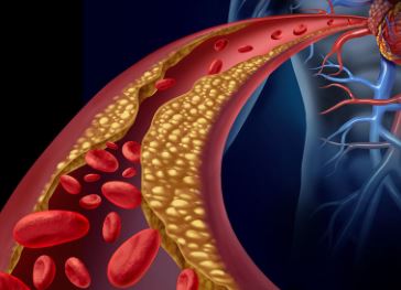  혈관청소에 좋은 음식 알아보기