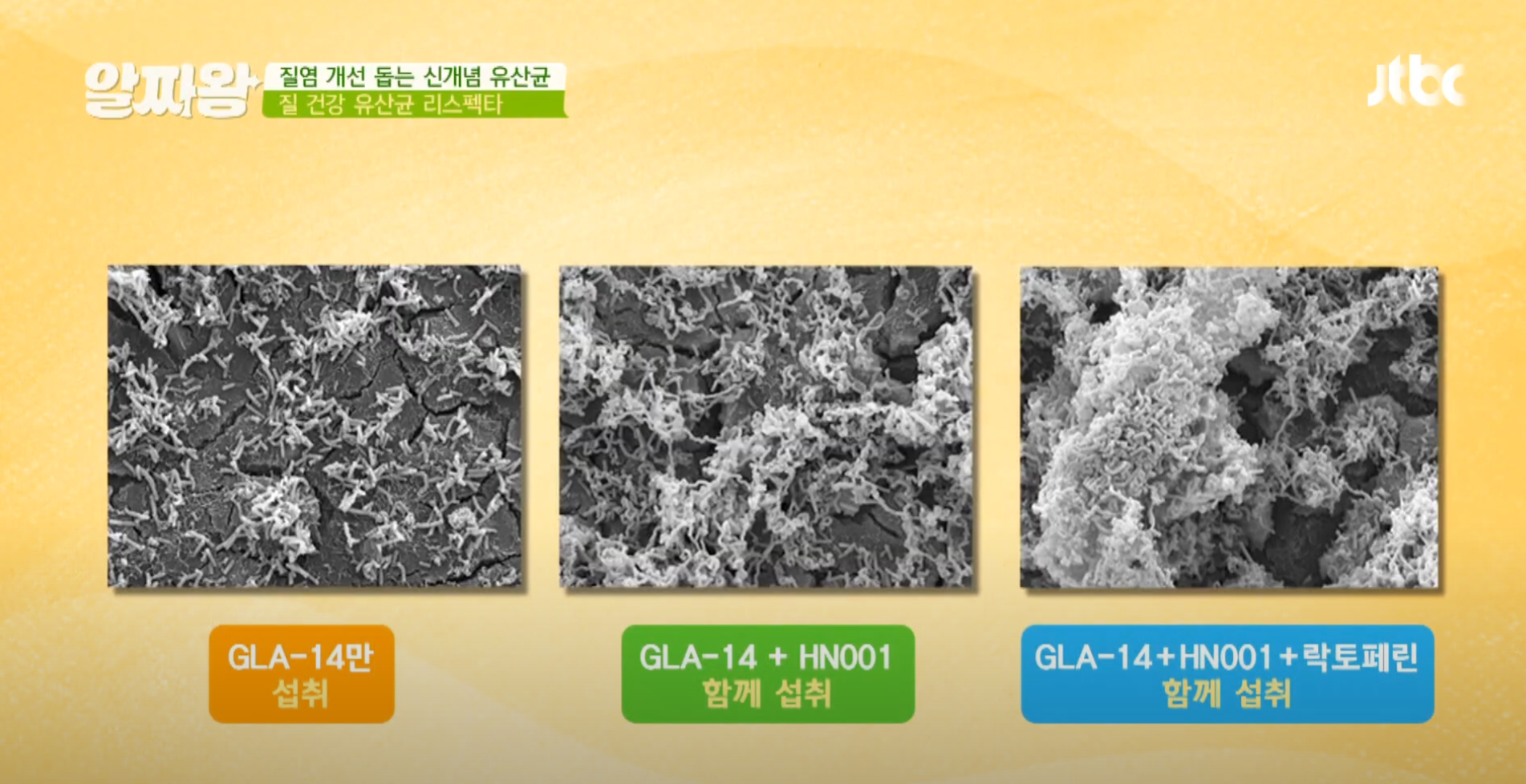  질염 개선에 좋은 리스펙타 유산균