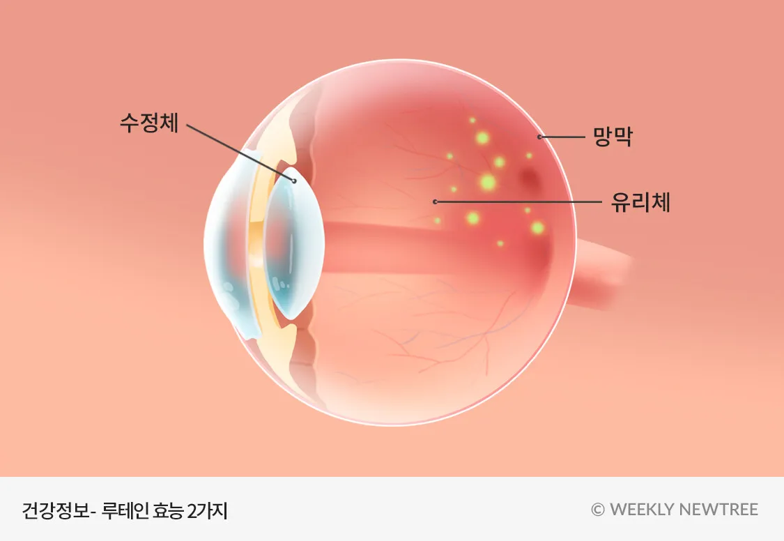 눈이 뿌옇게 보이는 증상