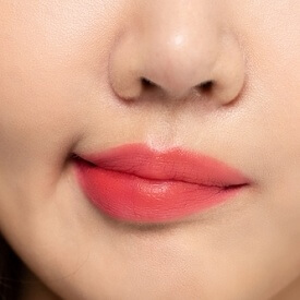  구안와사 초기증상, 원인, 치료