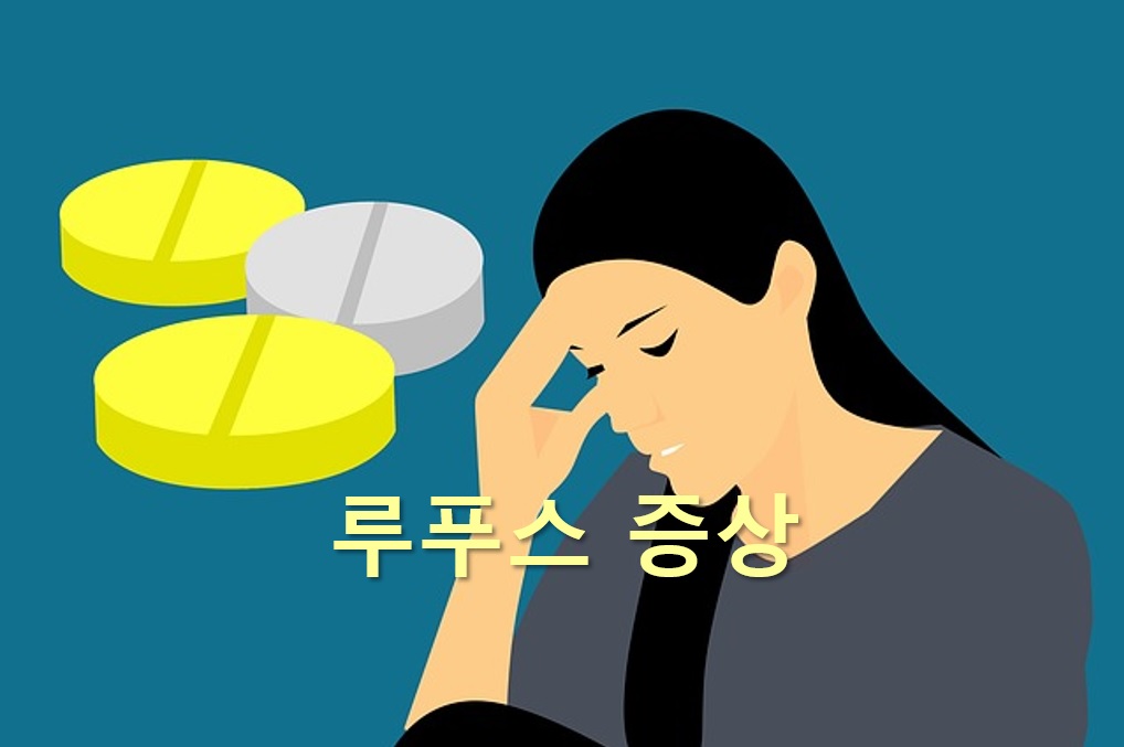  루푸스 증상과 루푸스 완치 가능성