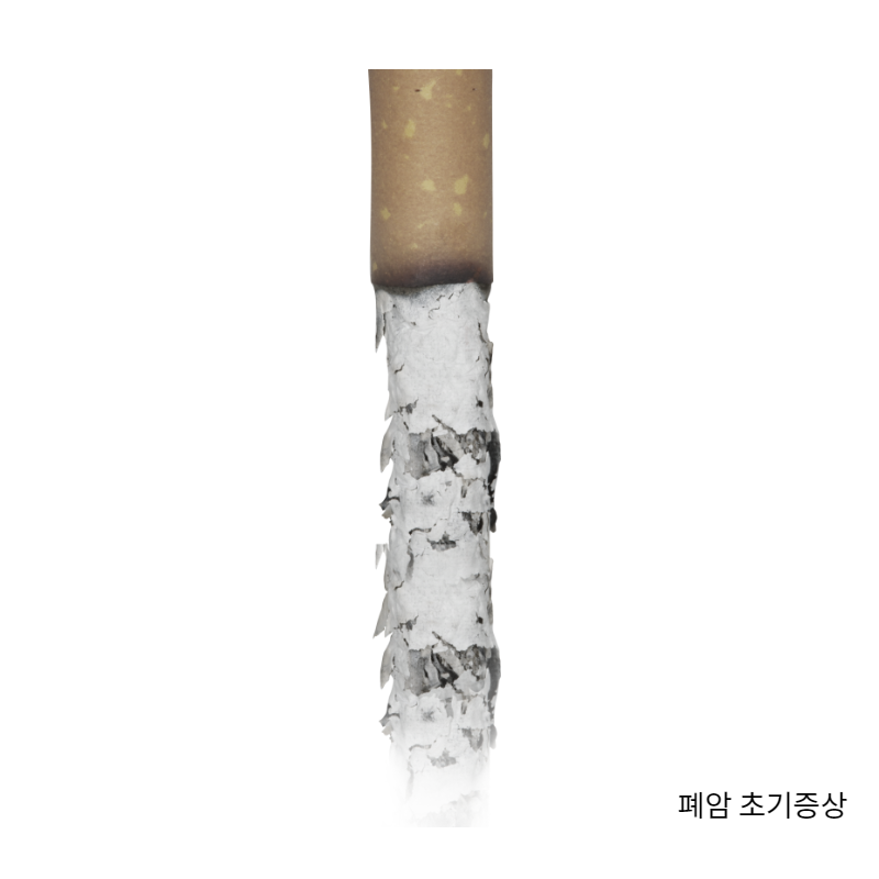 폐암 초기증상 담배