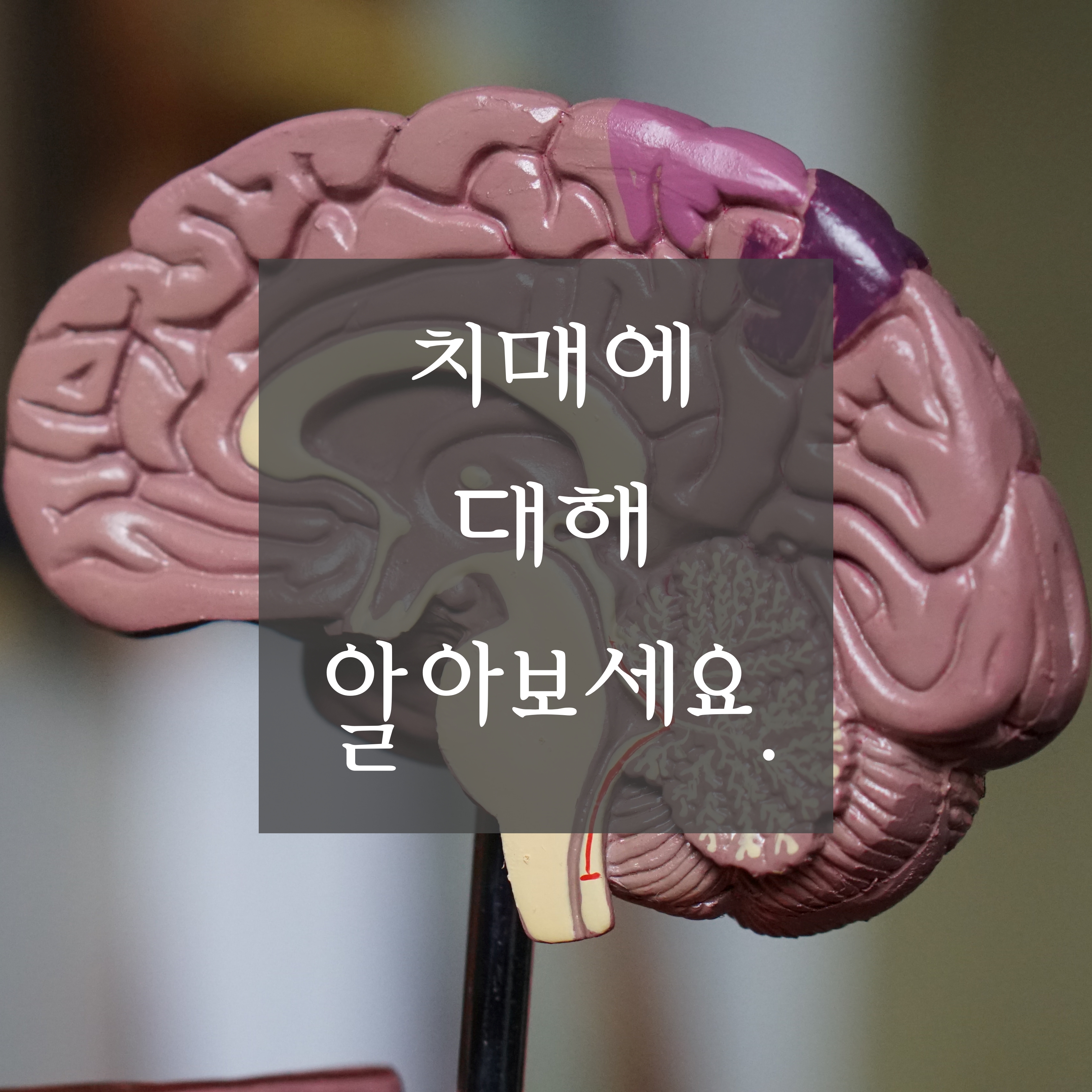 [치매에 대하여] 치매 의심 증상, 치매에 걸릴 확률이 높은 사람, 치매에 좋은 음식에 대해 알려드립니다.