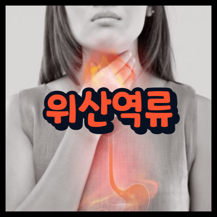  위산역류 커피 음식 원인 알아볼까요!